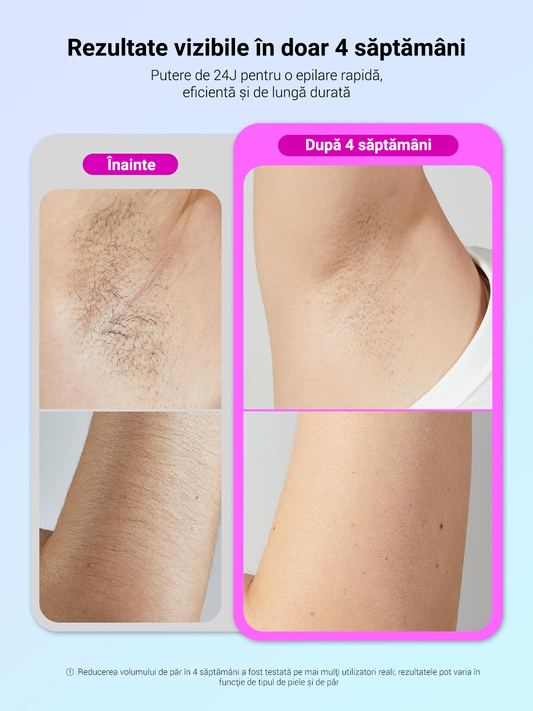 Epilator IPL Wavytalk